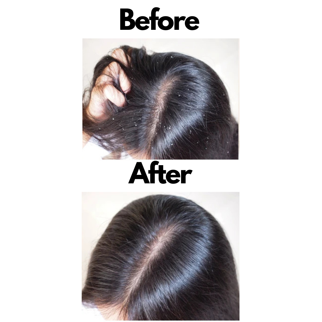 Anti-Hairfall and Dandruff Shampoo - Image 7