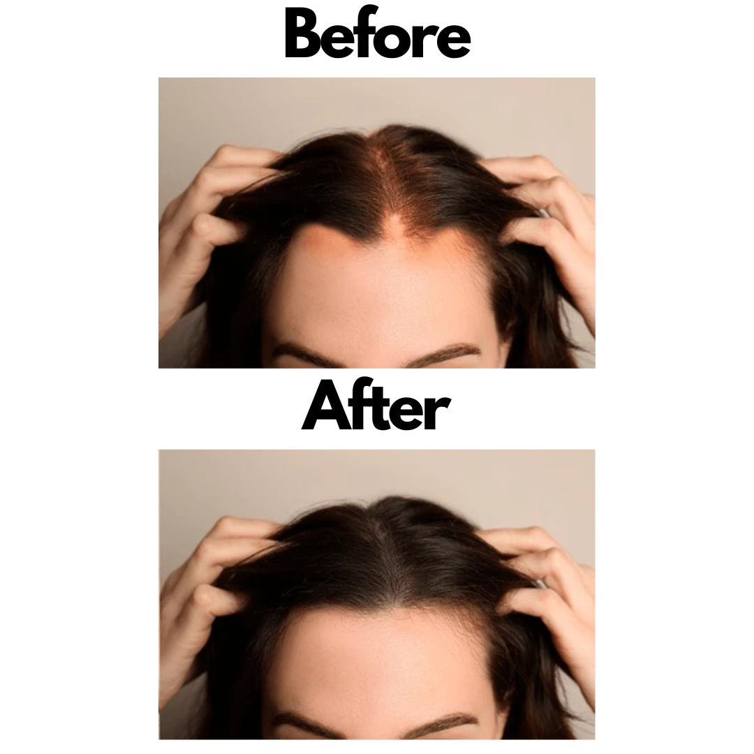 Anti-Hairfall and Dandruff Shampoo - Image 6